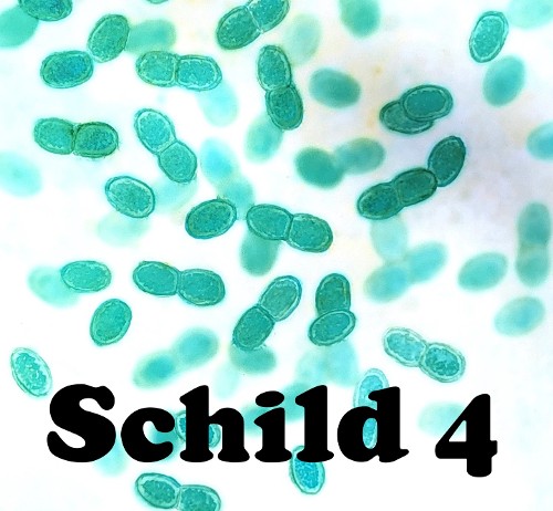 ERSTE CYANOBAKTERIEN (vor 3.500 Mio. Jahren)