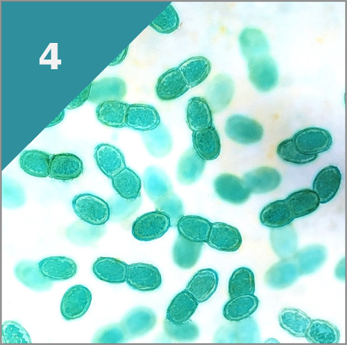 CYANOBAKTERIEN (vor 3.500 Mio. Jahren)